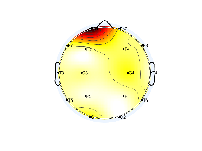 N05_S2_W20_S.png