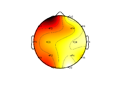 R12_S2_W6_S.png