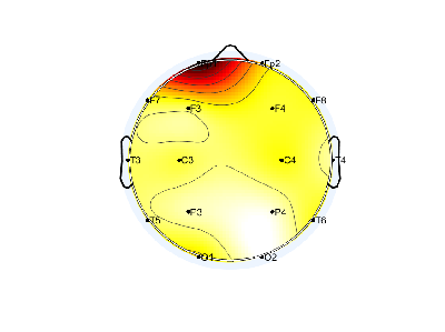 N05_S5_W17_S.png