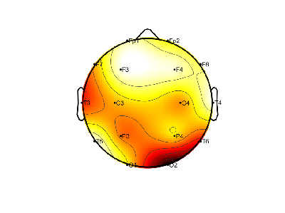 R15_S1_W60_S.png