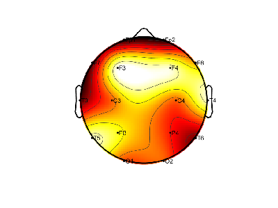 R15_S5_W18_F.png