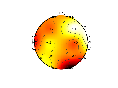 R15_S6_W31_S.png