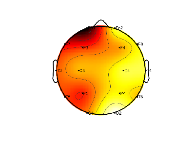 R12_S4_W38_F.png