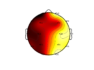 R11_S7_W59_F.png