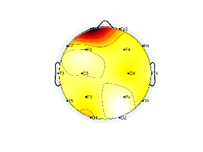N05_S1_W40_S.png