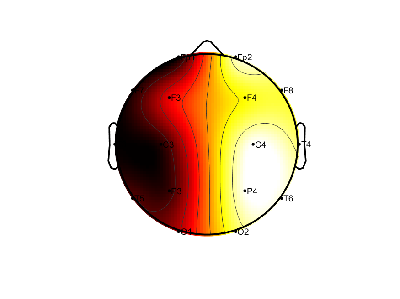 R11_S8_W18_F.png