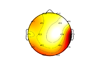 R08_S4_W30_F.png