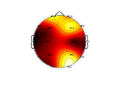 N04_S8_W45_F.png