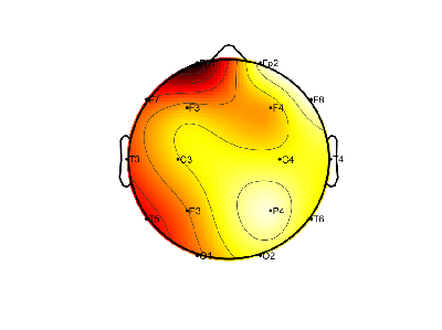 R12_S1_W15_S.png