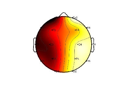 R11_S8_W59_F.png