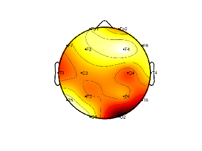 R15_S2_W12_F.png