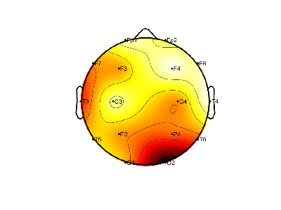 R15_S1_W2_S.png