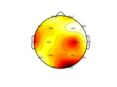 R15_S1_W28_S.png