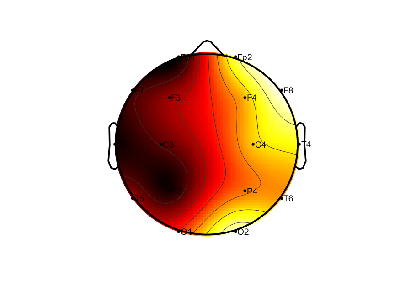 R11_S2_W18_F.png