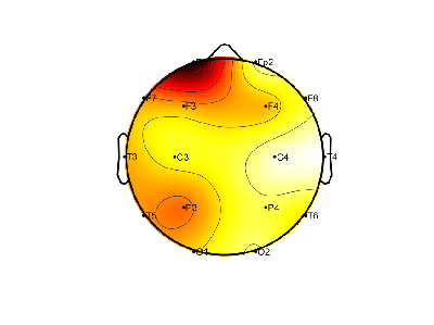 R12_S7_W31_S.png