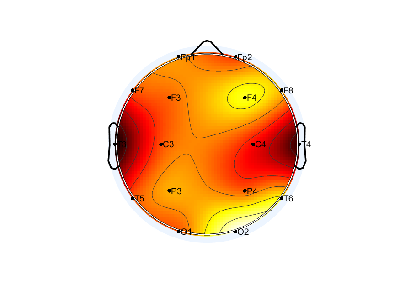 N04_S6_W36_F.png