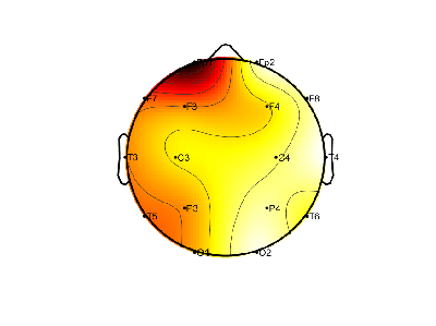 R12_S6_W14_S.png