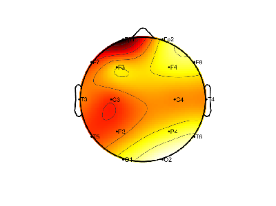 R12_S2_W58_S.png