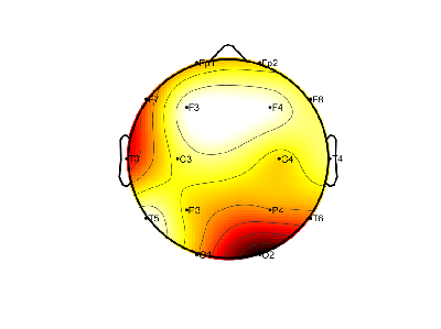 R15_S4_W14_S.png