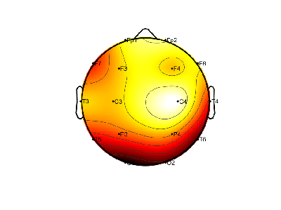 R08_S3_W40_S.png