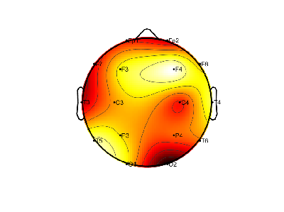 R15_S3_W26_F.png