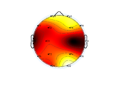 N04_S3_W45_F.png