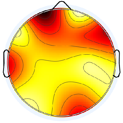 N01_S4_W18_F.png