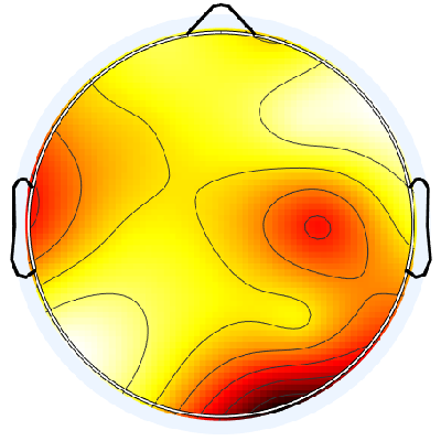 R15_S2_W15_S.png