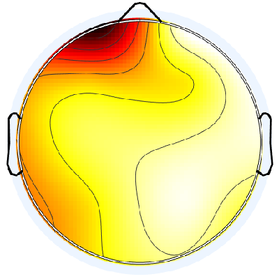 R12_S1_W32_S.png