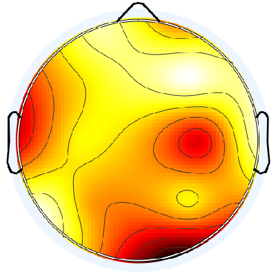 R15_S1_W25_S.png