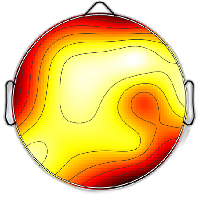R15_S2_W34_F.png