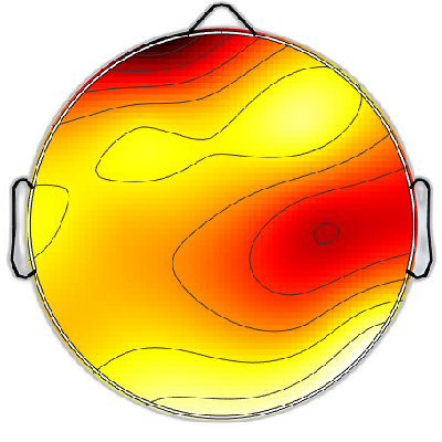 R12_S2_W60_S.png