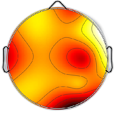 R15_S1_W9_F.png