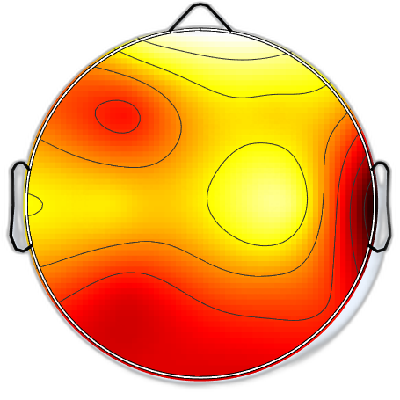 R08_S1_W5_F.png