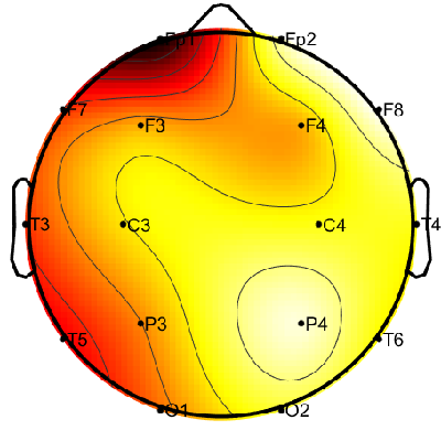 R12_S1_W15_S.png