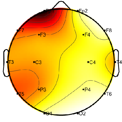 R12_S1_W11_S.png