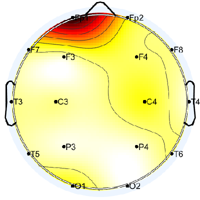 N05_S2_W20_S.png