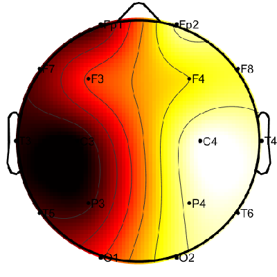 R11_S2_W50_F.png