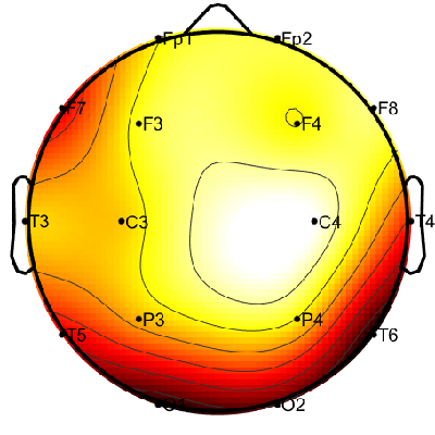 R08_S2_W57_S.png