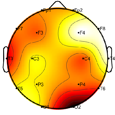 R15_S6_W31_S.png