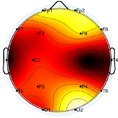 N04_S3_W45_F.png