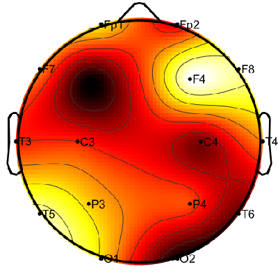 R15_S2_W50_F.png