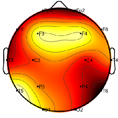 R15_S5_W50_F.png