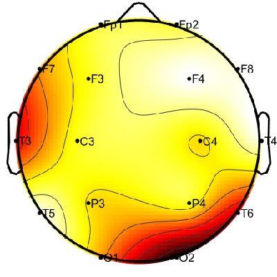 R15_S2_W59_S.png