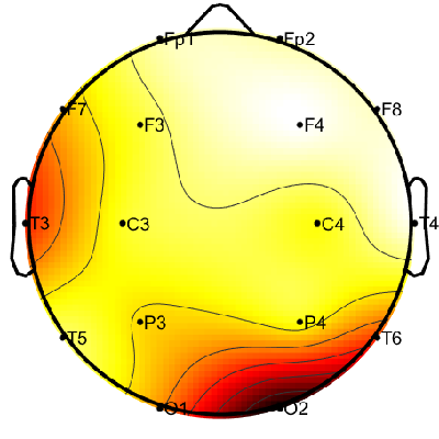 R15_S2_W16_S.png