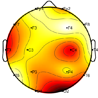 R15_S1_W25_S.png