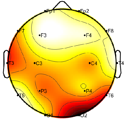 R15_S1_W60_S.png