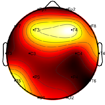 R15_S5_W51_F.png