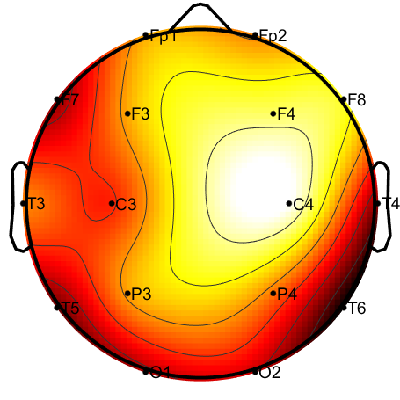 R08_S1_W26_F.png