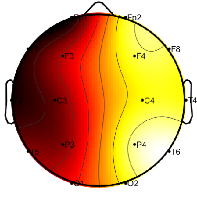 R11_S7_W45_F.png